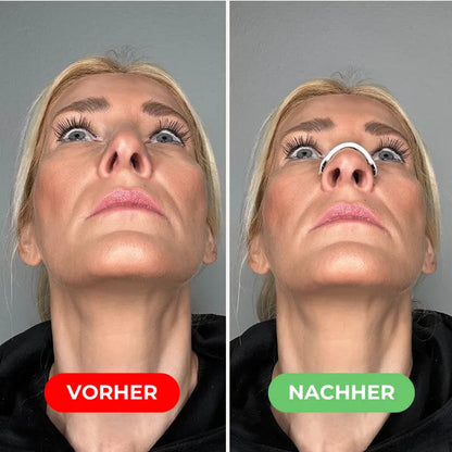 Nasenclip zur besseren Atmung und gegen Schnarchen