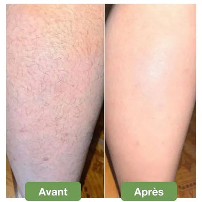 Gomme d’Épilation Douce