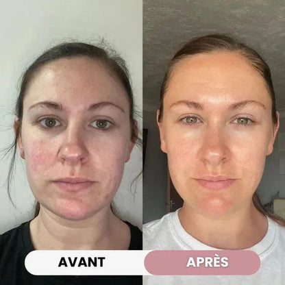 Sculpteur facial 7-en-1