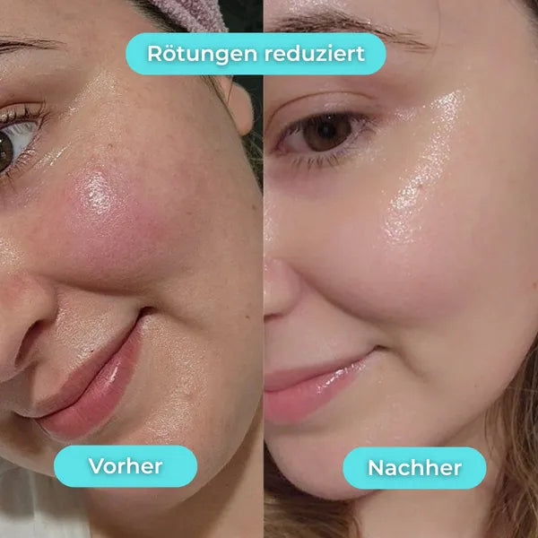 Bassin glacé pour le visage