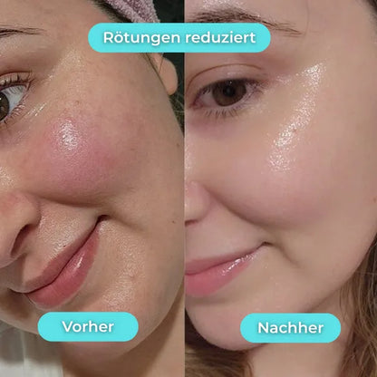 Bassin glacé pour le visage