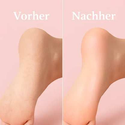 Elektrischer Hornhautentferner