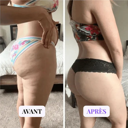 Appareil de Massage Minceur Anti-Cellulite