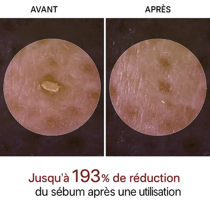 Sérum Exfoliant Pores & Imperfections