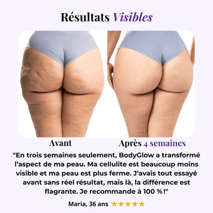 Appareil de Massage Minceur Anti-Cellulite