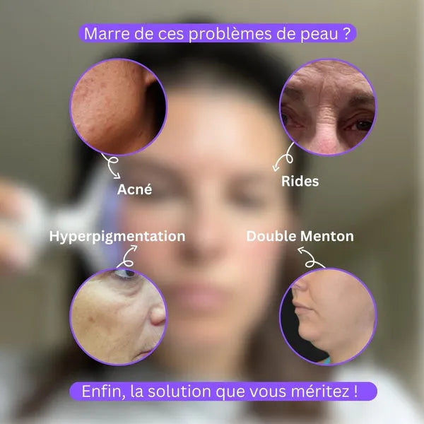 Appareil Lifting Visage et Cou à Microvibrations