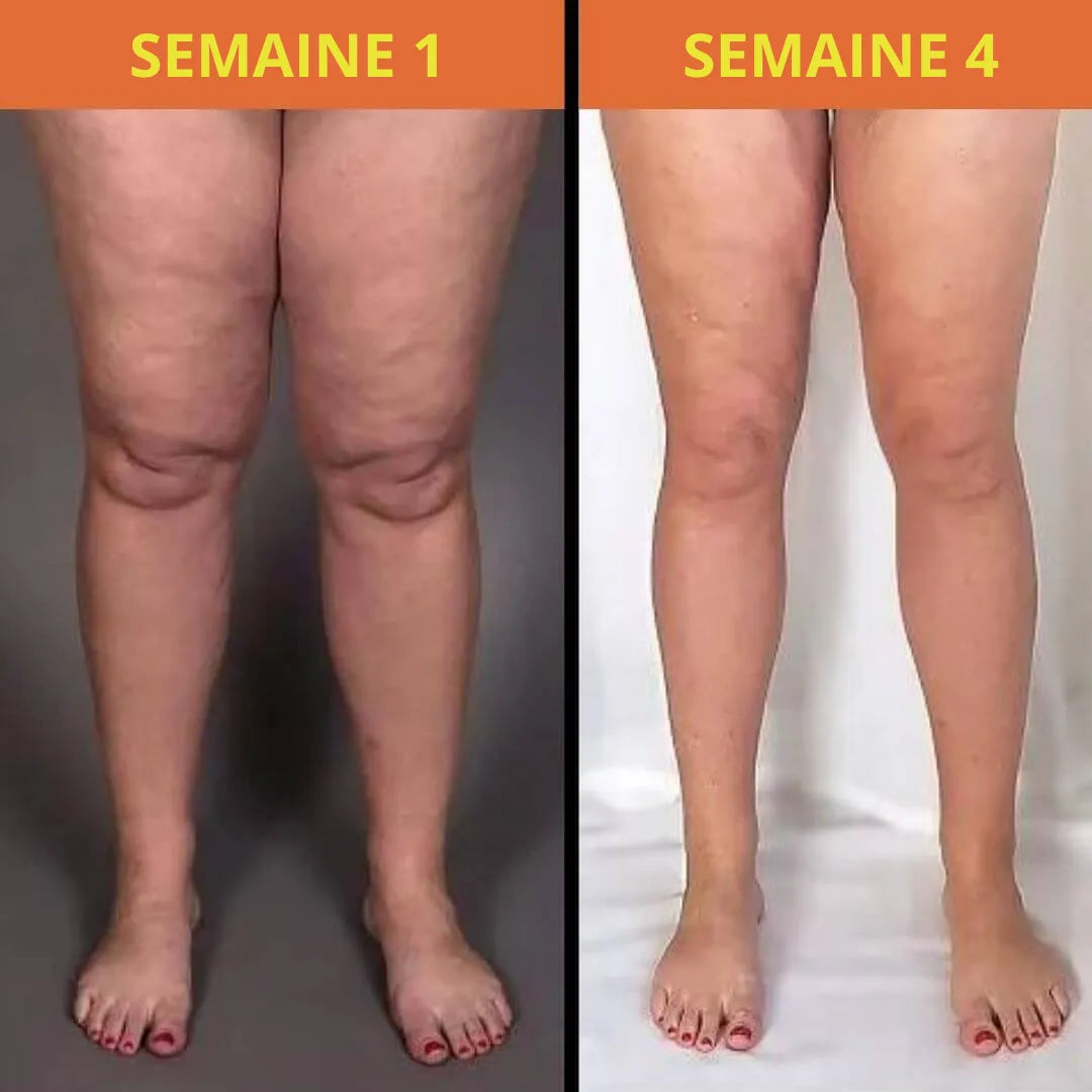 Masseur Plantaire Énergétique