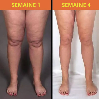 Masseur Plantaire Énergétique