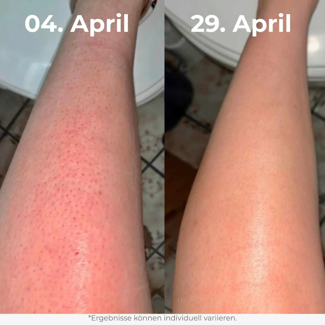 Glow Rice Peeling Duo