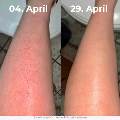 Glow Rice Peeling Duo