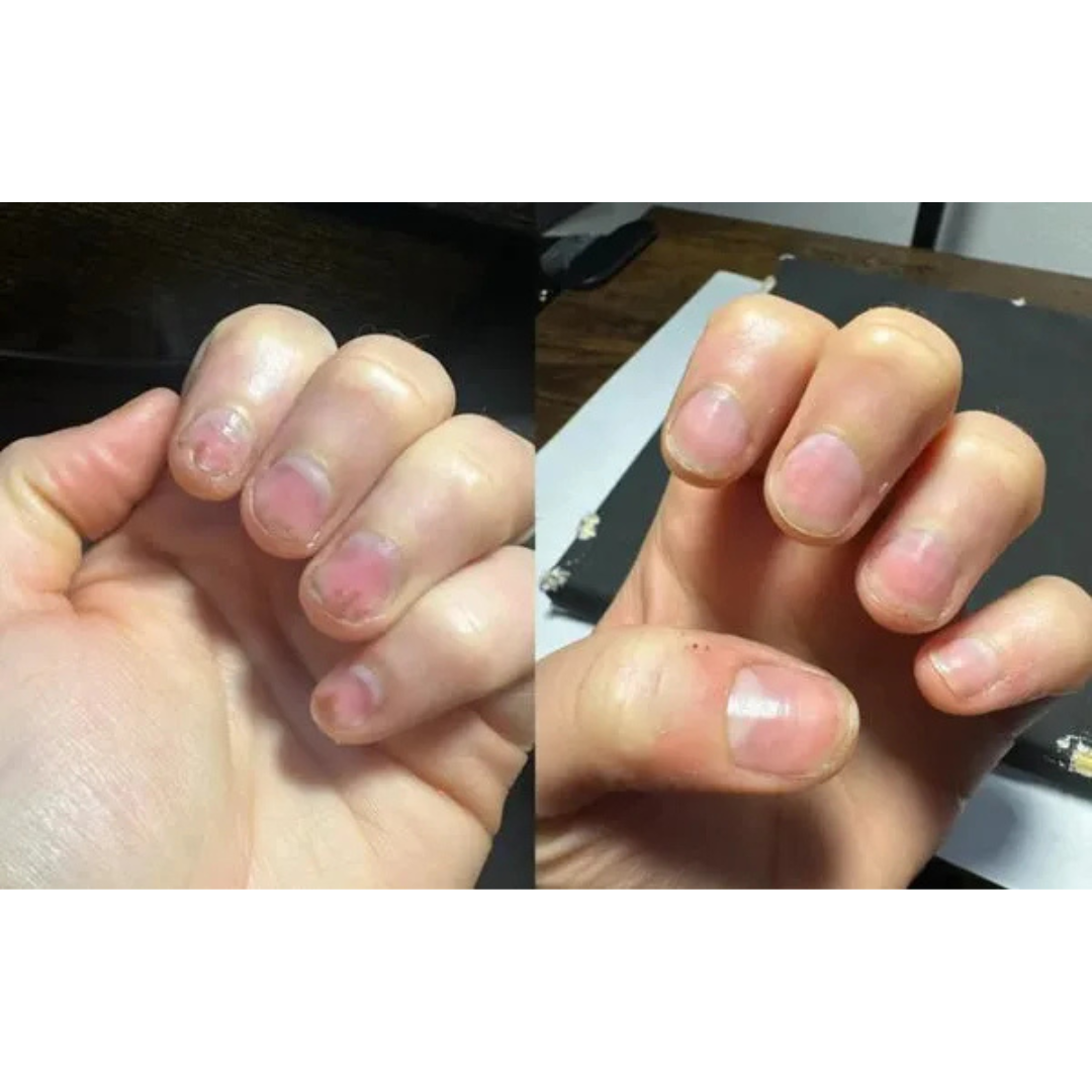 Nagelpflege-Stift mit Stammzellen