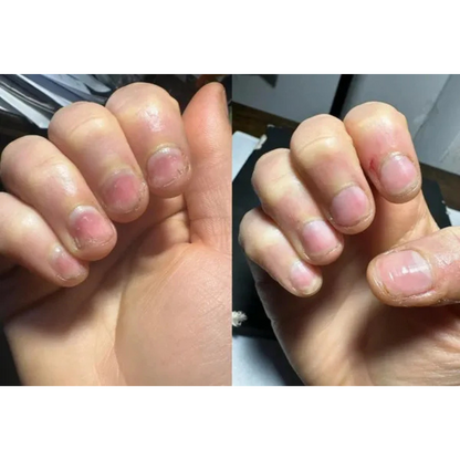 Nagelpflege-Stift mit Stammzellen