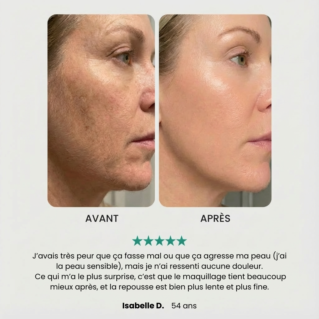 Präzises und schmerzfreies Haarentfernungsgerät