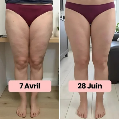 Straffende Leggings gegen Cellulite