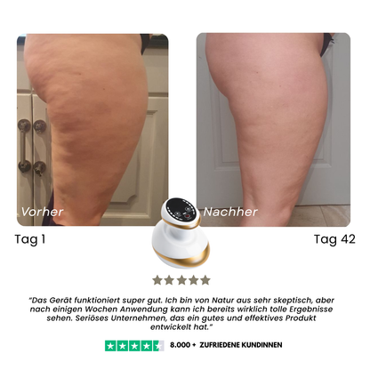 Beheizbares Anti-Cellulite-Massagegerät