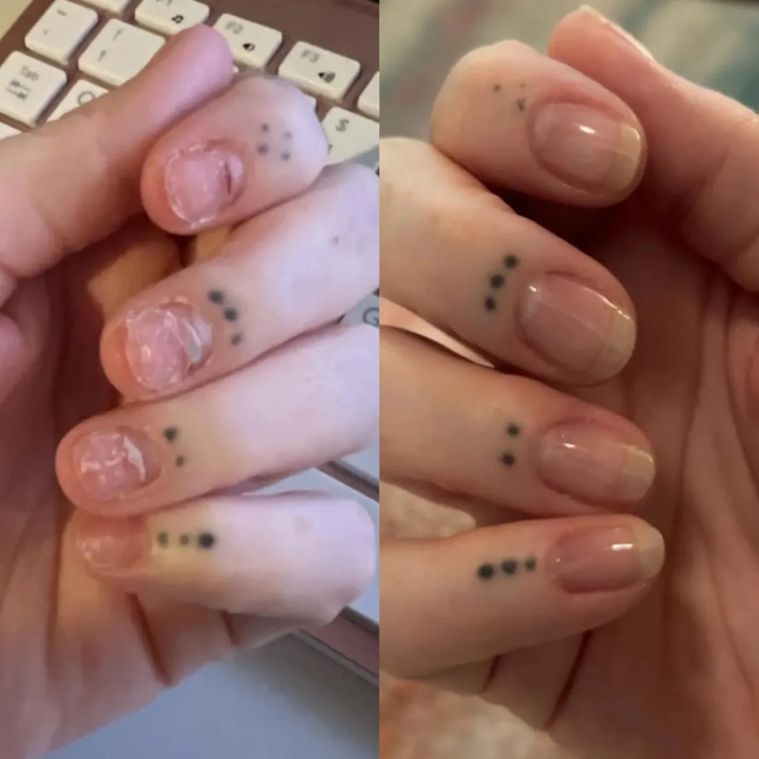 Nagelpflege-Stift mit Stammzellen
