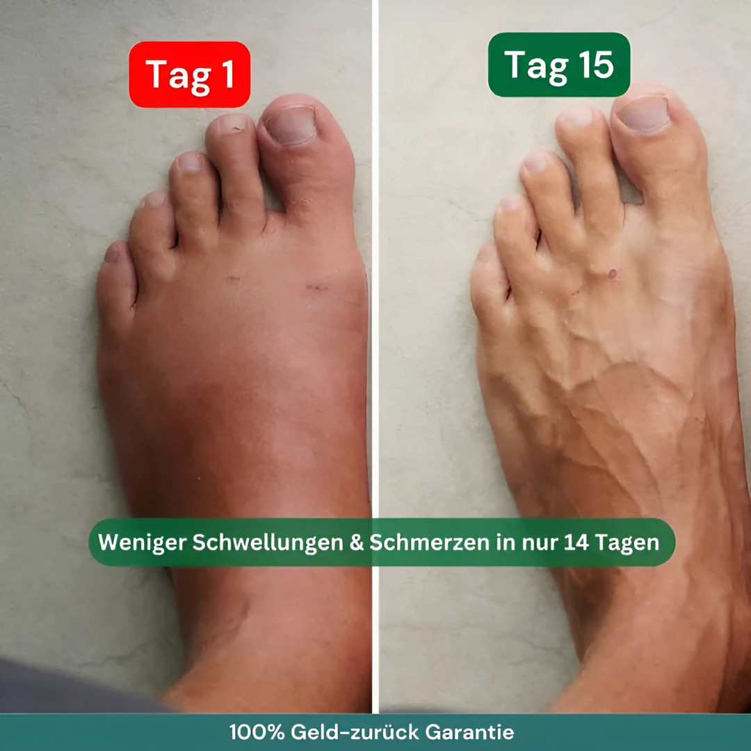 Kompressionssocken mit 3-Zonen-Stütze