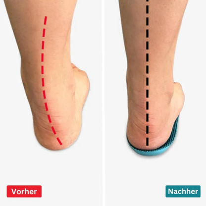Orthopädische Gel-Einlegesohlen