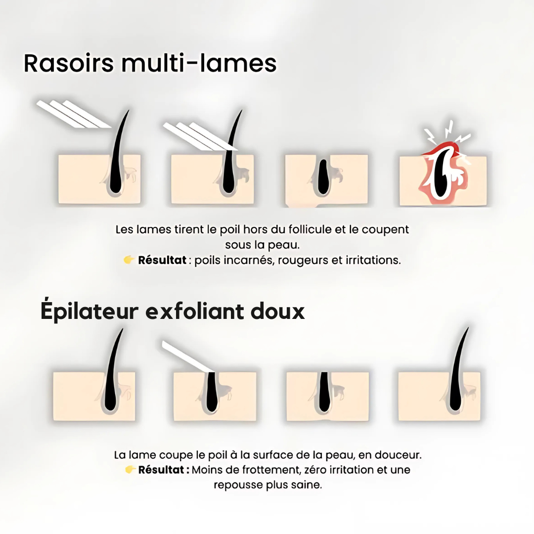 Sanftes Peeling-Epilierer