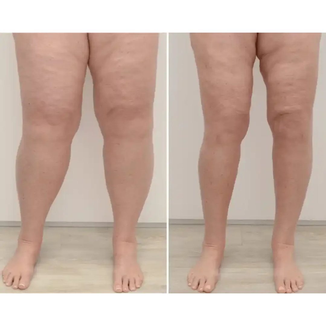 Energetischer Fußmasseur