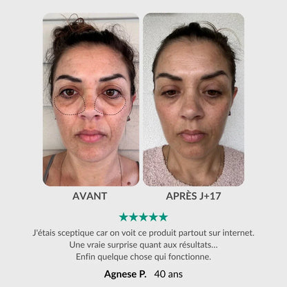 Stift & Serum für die Augenkontur