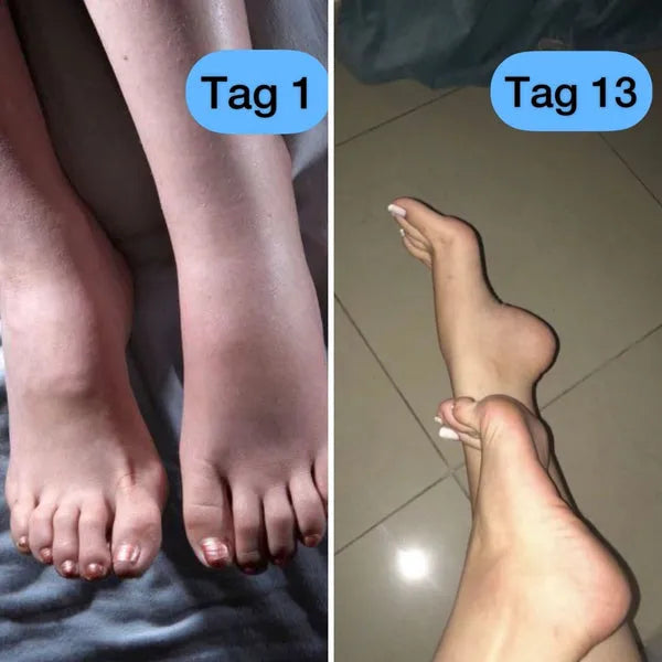 Kompressionsstrümpfe gegen schwere und schmerzende Beine