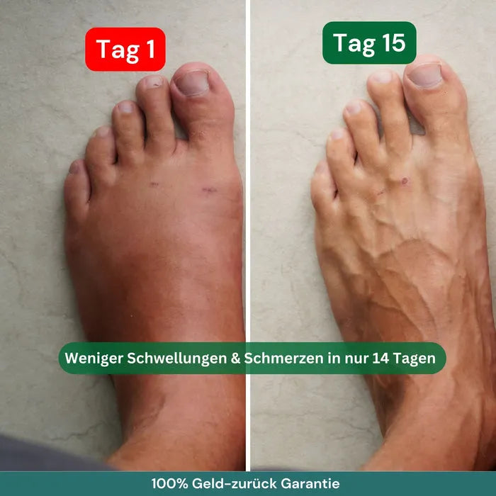 Kompressionsstrümpfe gegen schwere und schmerzende Beine