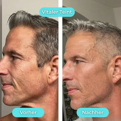 Eis-Gesichtsbecken