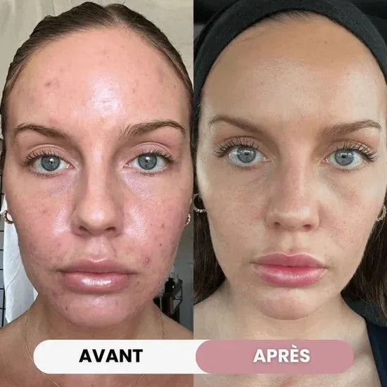 7-in-1-Gesichtssculptor