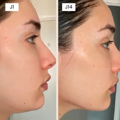 Gesichtsmaske Fit Mask