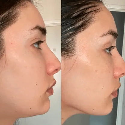 7-in-1-Gesichtssculptor