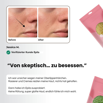 Epila Starter-Set - Für glatte Haut ohne Rasur