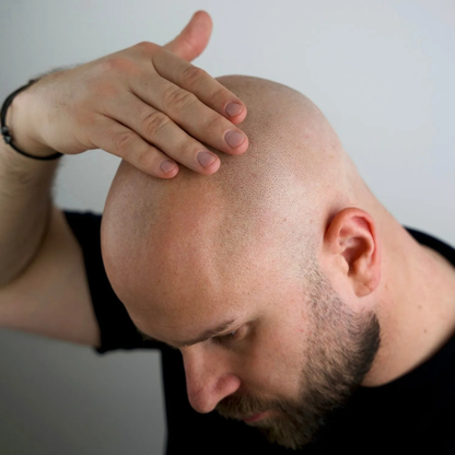 Set di Glatzenrasierer