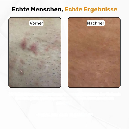 Körper- und Intimrasierer