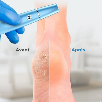 Apparecchio per pedicure anti-calcificazione