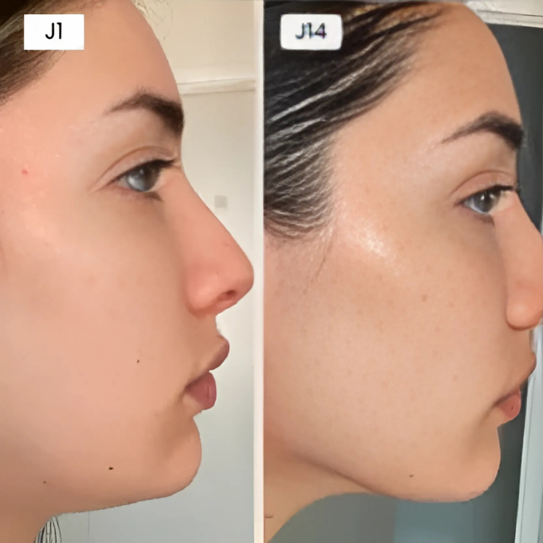 Maschera viso rassodante riutilizzabile con effetto lifting