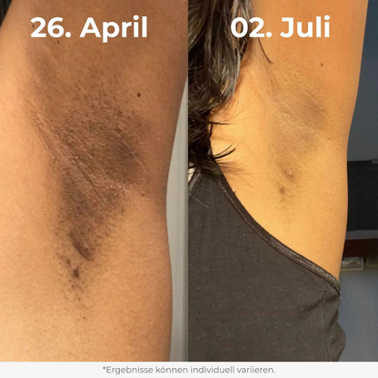 Duo di peeling al riso luminoso