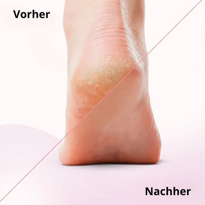 Elektrischer Hornhautentferner für weiche Füße (fornitore di trombe elettriche)