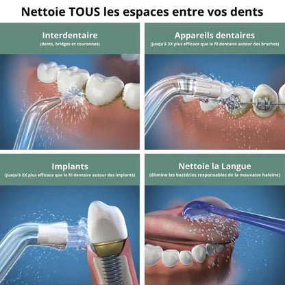 Hydropulseur Dentaire - L'essenziale per un bel sorriso