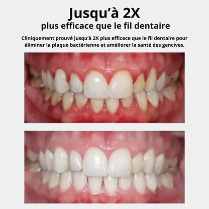 Hydropulseur Dentaire - L'essenziale per un bel sorriso