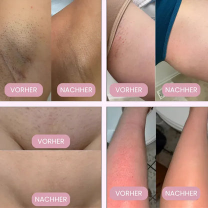 Set di apparecchi per l'alloggiamento dei passeggeri senza sequestri