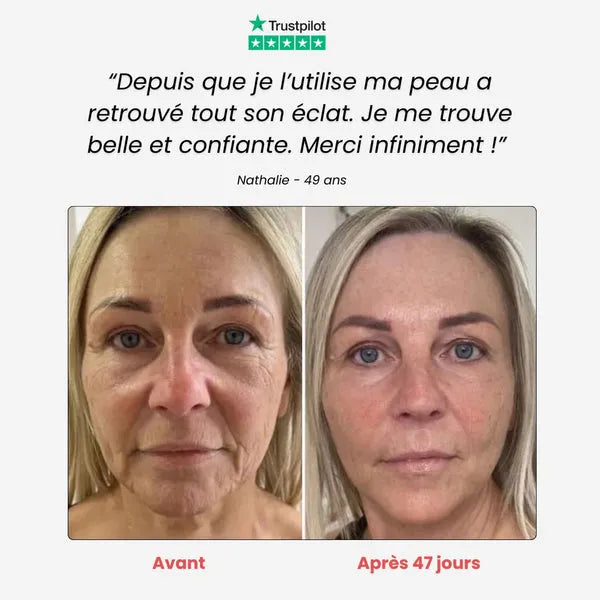 Dispositivo rassodante per il viso Lumi Beauty