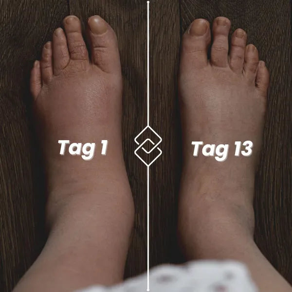 Strisce di compressione contro le malattie gravi e gravi